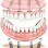 Dental Implants Sedation and General Dentistry