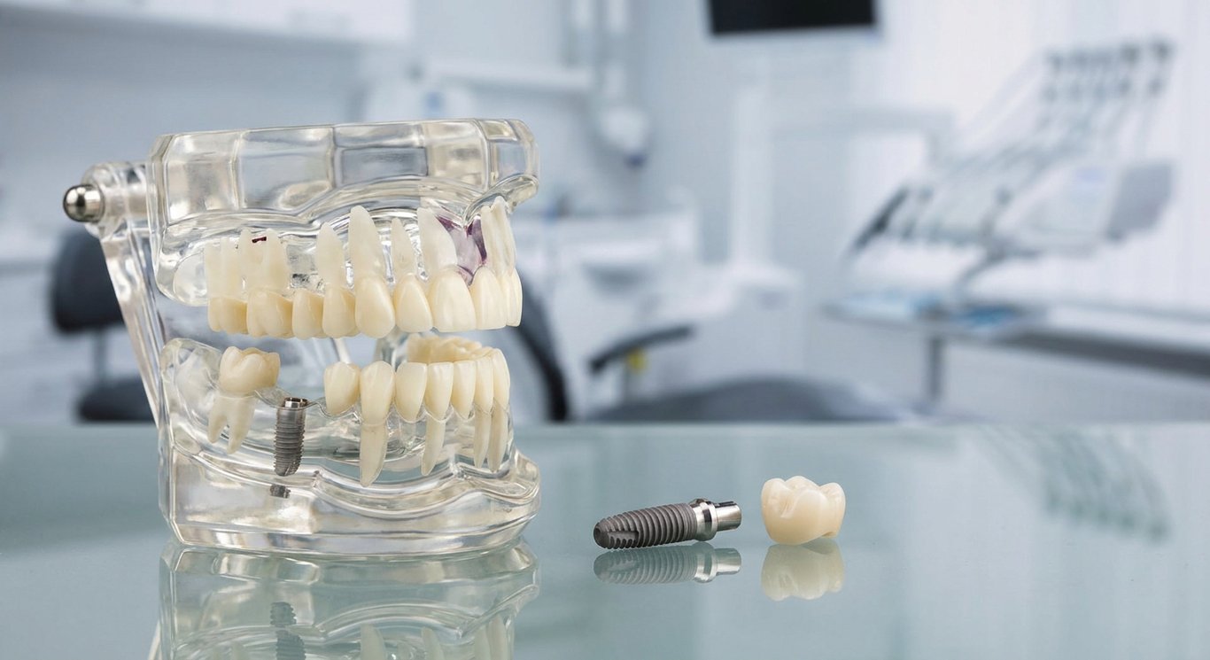 What Happens During a Dental Evaluation?